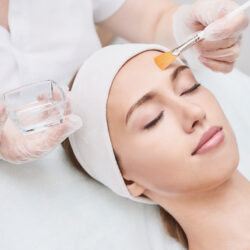 Female patient receiving facial chemical peel treatment