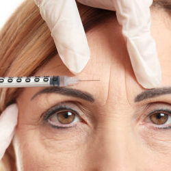 Botox, dermal filler injection for facial wrinkles