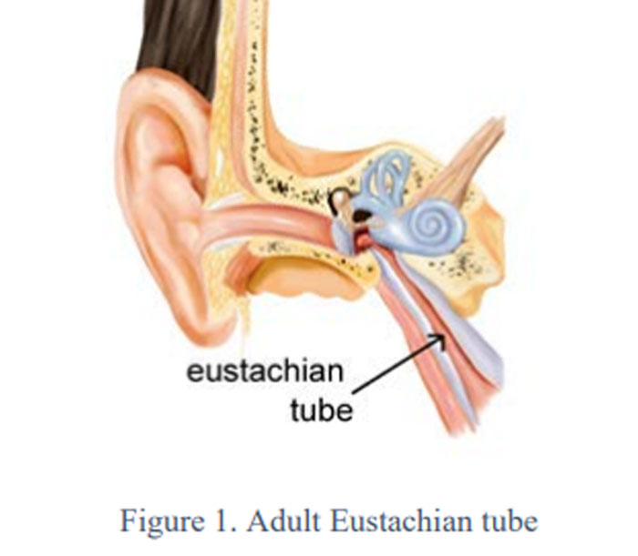 tube ear infection tube ear infection